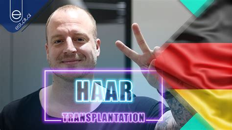 Haartransplantation: Erfahrungen und Empfehlungen.